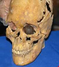 Shahr-e Sukhteh (Shahr-i Sokhta)